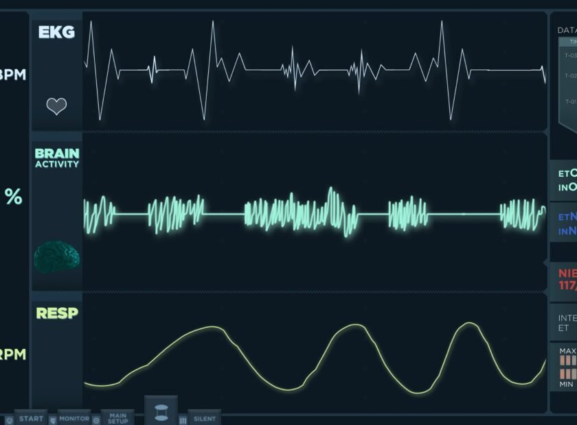 animation-fast-electrocardiogram-reading-display-heartbeats-are-getting-more-intense (1)