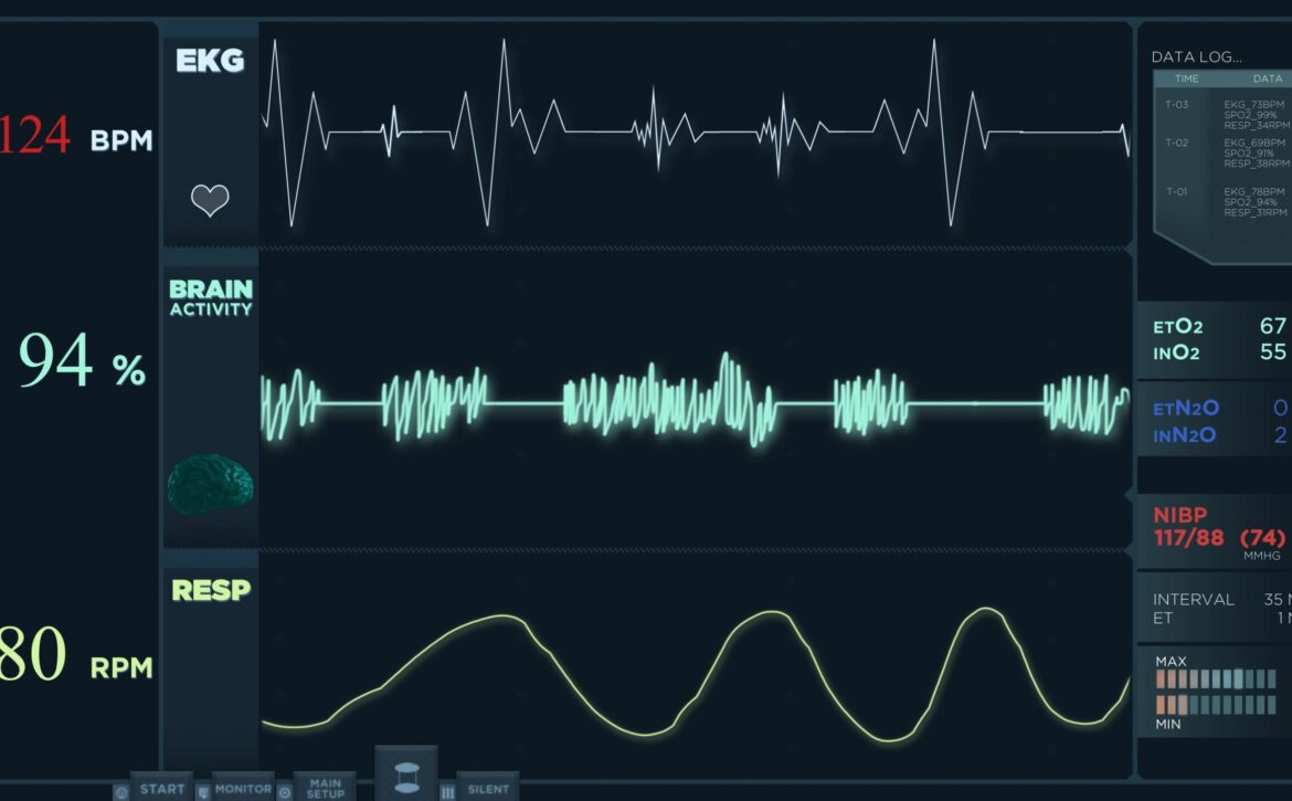 animation-fast-electrocardiogram-reading-display-heartbeats-are-getting-more-intense (1)